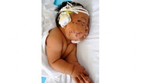 Henz 8 aylk minik oluna gsn srd iin kzan anne olunu makasla 90 yerinden yaralad.