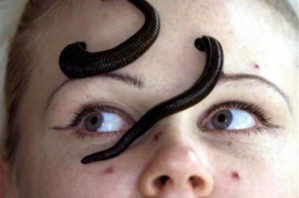 Bu yntem, rnein geri dikilen bir parmakta kan akn artrmakta kullanlyor.