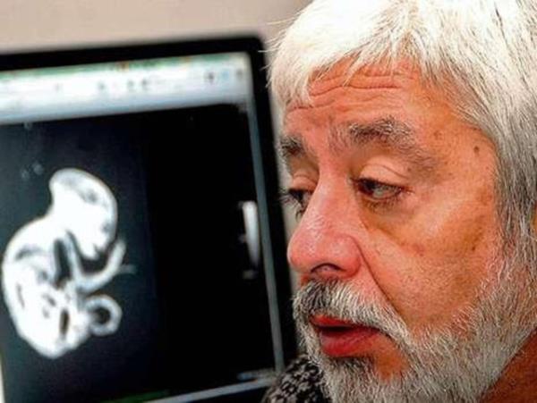 Etobur bir hayvann di yapsna sahip bu yaratn; ayn zamanda kafatas yaps itibariyle de dier hayvanlara gre daha yksek zeka seviyesine sahip olduu dnlyor. Yaratn eklem ve i kulaklar yapsyla insana benzedii iddia ediliyor.