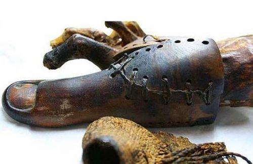 Ayak ba parma protezi.. Grnts bile tyleri rpertmeye yetiyor.