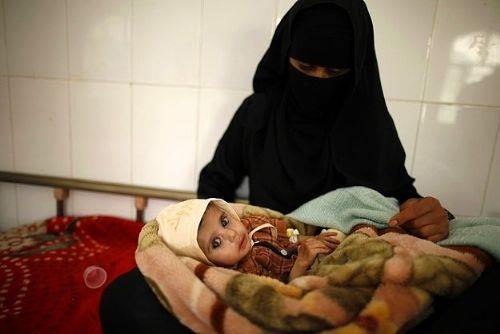 <p><b>YEMEN </b></p>    Yemen'de kzlarn sadece %53' ilkokula gnderilmektedir. Kadnlarn binde 2'si, doum srasnda hayatn kaybetmektedir. Fotoraftaki kadn Yemen'deki bir a evinde yetersiz beslenen ocuuyla fotoraflanm.