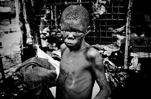 Bu baktaki mutsuzluk ve umutsuzluk elle tutulur hale gelmi