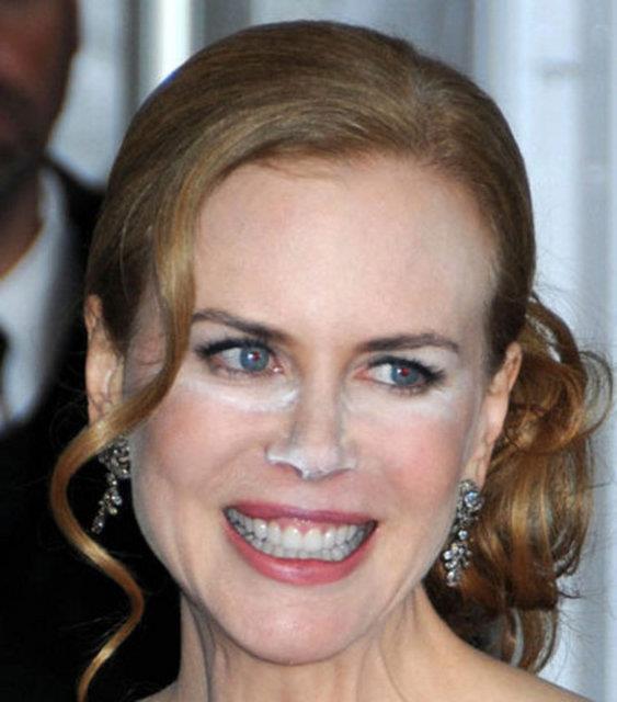 Nicole Kidman