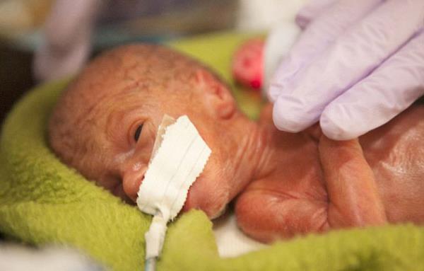 Bebeklerin ilk anlarn cretsiz olarak fotoraflayan ve ailelere destek olan gen kadn...