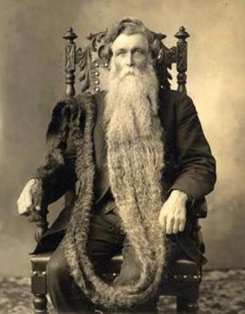 Avusturyal Hans Steininger 1,4 metre ile dnyann en uzun byna sahip olmakla nldr. 1567 ylnda bir gn yaad ehirde yangn kt. Hans da kaarken byn toplamay unuttu. Koarken bynn zerine bast ve dengesini kaybederek dt. Yuvarlanrken boynunu krd ve ld.