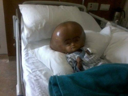 Roona'nn annesi Fatima Khatun, onun ok daha iyi olduunu kafasn dz tutabildiini ve kendi kendisine hareket ettirebildiini