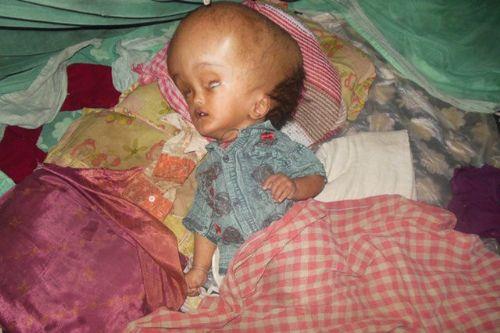 baka ocuklara cevap verebildiini ve ad sylendiinde glmsediini syledi.