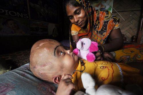  yanda yaama ans ok dk denilen ocuk geirdii ameliyat sonrasnda ilk defa glmsedi