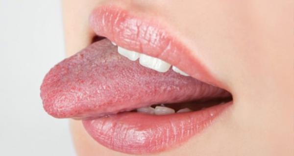 Her insann dilinin izi de parmak izi gibi farkldr.