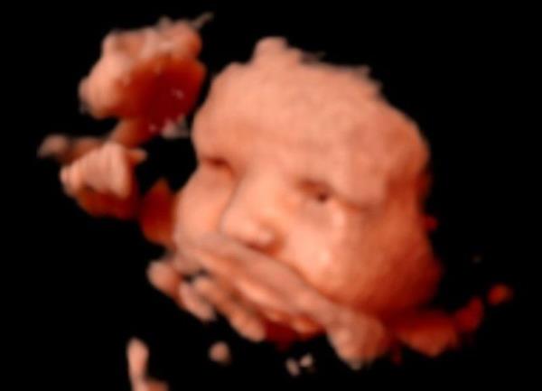 Yedinci ayda bebek ok net bir ekilde grlr. rnein bebein parmaklar bu ayda saylabilirken daha sonrasnda bebek yumruk yapt iin parmaklar saylamayacaktr