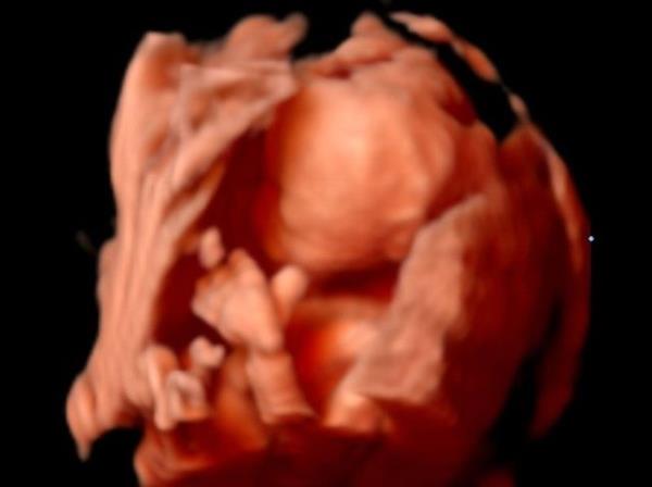 kinci ayda bebekte artk organlar normalde nerede olacaksa hcreler o tarafa doru g eder. Kalp atmaya balar