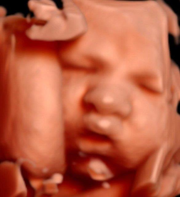 Drdnc ayda bebek, biraz daha byyor, vcut hareketleri daha gl oluyor, parmaklarn hareket ettiriyor