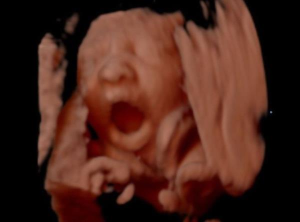 Bebek sekizinci ayda doduu pozisyona giriyor