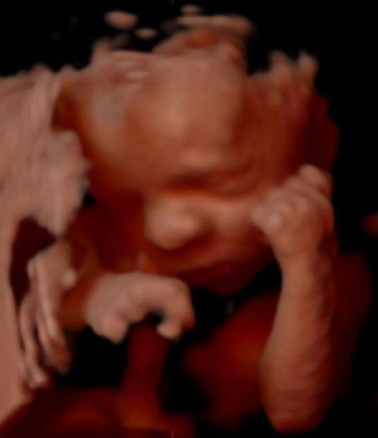 Beinci ayda yz hareketleri, mimikleri balyor, tepkilere cevap veriyor