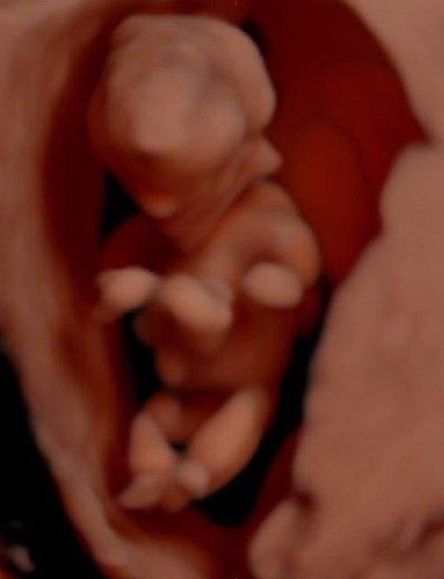 Dokuzuncu ayda bebek, domu bebein her trl zelliini tayor. Bu aylarda hzl kilo alyor