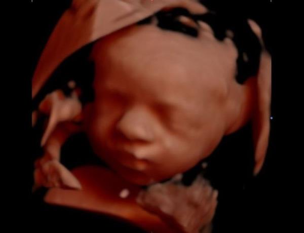 Altnc ayda bebek, anne karnnda iskelet gibi grntsnden daha dolgun hale geliyor. Bebein yznde dolgunlamalar balyor