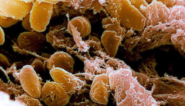 nk hasta be gn iinde hayatn kaybediyordu.