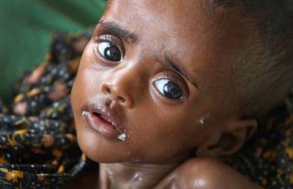 Hastalk, genelde, dk bulam kirli su ya da bu sularla ykanm gdalar aracl ile yaylr.