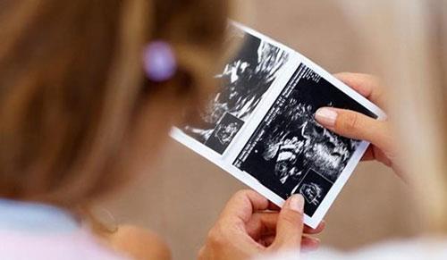 <p><b>YANLI: Sk sk ultrason takibi yaptrmak iyidir</b></p>    DORUSU: Dnya Salk rgt; hamilelik boyunca: 11-14. gebelik haftasnda bebein Down Sendromu asndan deerlendirilmesi  (ikili kombine test, ense kalnl testi), 22. haftada bebein anatomisinin deerlendirilmesi  (ayrntl-detayl ultrason) ,  30. haftada gelime geriliine baklmas ve 36. haftada genel deerlendirme olmak zere hamilelik boyunca 4 ultrason takibi neriyor.