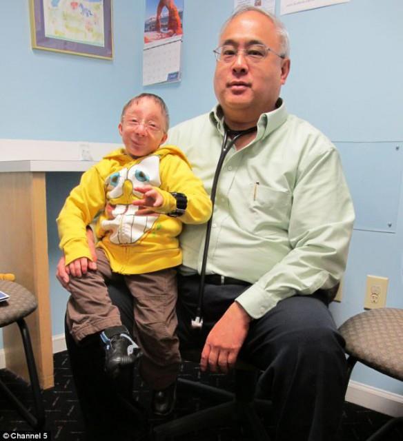 Atlanta'da Nick Smith ilkel ccelik hastalndan dolay boyu 90 cm.