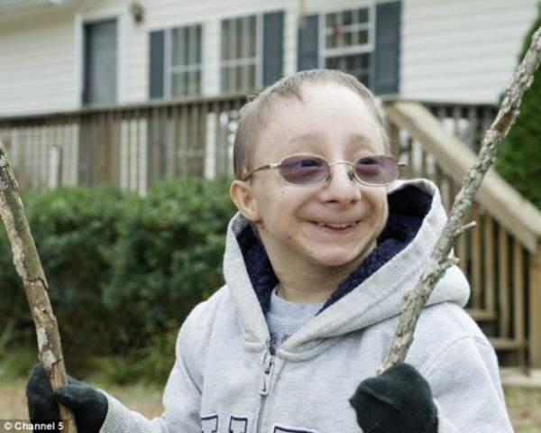 Atlanta'da Nick Smith ilkel ccelik hastalndan dolay boyu 90 cm.