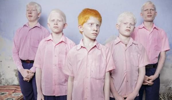 <br><b>KURGU PORTRELER BRNCLK DL</b></br>  Brent Stirton, Gney Afrika, Reportage by Getty Images  <br>25 Eyll 2013, Bat Bengal, Hindistan</br>  Hindistan'n Bat Bengal blgesinde, krler iin bir yatl okul olan Vivekananda Misyoner Okulu'nda poz veren kr albino renciler. Okul, Hindistan'daki krlere ynelik nadir okullardan biri.