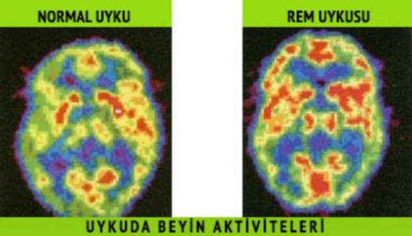 Uykudan uyanmamza ramen REM uykusundaki fizyolojik fel hali(gz ve solunum kaslar)