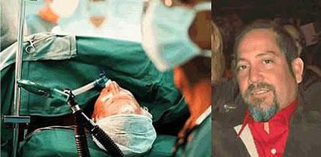 <p><b>200.000 Dolarlk dava atlar</b></p>  Bir baka yanl ameliyat vakas da 47 yandaki Hava Kuvvetleri Emeklisi Benjamin Houghton'n bana geldi. Sol testisindeki klme ve ardan ikayet eden Benjamin'in doktorlar, kanser korkusuyla sol testisini almak iin ameliyat karar aldlar. Fakat bu operasyonla ilgili olan grevliler ameliyat ncesi doldurduklar formlarda baz yanllklar yapt ve bu yzden de Houghton'un sol yerine sa testisi alnd. Houghton ve einin at dava sonucu, yaplan bu yanllk, West Los Angeles VA Medical Center'a 200.000 dolara mal oldu.