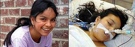 <p><b>Yanl kalp ve cier naklinden hayatn kaybeden kz</b></p>  Hastann kan grubuyla uyumsuz kalp ve akcierlerin nakledilmesinden 2 hafta sonra 17 yandaki Jesica Santillan hayatn kaybetti. Duke niversitesi Medical Center doktorlar, operasyon ncesi bu organlarn hastann kan grubuyla olan uyumunu kontrol etmediler. Bu hatalarn telafi etmek iin yaptklar ikinci bir organ nakli ameliyatndan sonra, Jesica'nn beyni hasar grd ve kan sorunlar hastann lmn daha da hzlandrd. Meksikal gmen Santillan, 3 yl nce hayatn tehdit eden kalp rahatszl sebebiyle ABD'ye gelmi ve Durham'daki Duke niversitesi Hastanesinin cerrahlar, kalp naklinin bir umut olabileceini dnmler; fakat kan grubu Rh 0 olan Jesica'ya, kan grubu Rh A olan organlar naklederek onun hayatn tehlikeye soktular. Bu hata, hastay komaya soktu ve bu hatann ardndan uyumlu organlarn nakli yaplmasna allrken hastay kaybettiler ve hastane byle bir hatann yan sra uyumlu organlarn naklindeki gvenlik ihlalleri gz nne alnarak suland. Duke niversitesi, aileyle st kapal bir anlama yapt ve bu anlamaya gre de hem ailenin hem de niversitenin herhangi bir aklama yapmas yasakland.