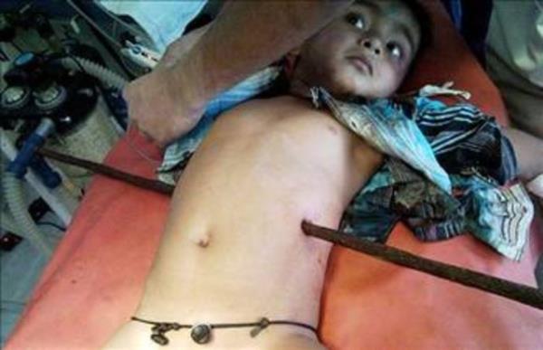 3 yandaki bu Hintli ocuk, dini kutlamalar esnasnda atdan dm ve vcuduna demir ubuk saplanm.