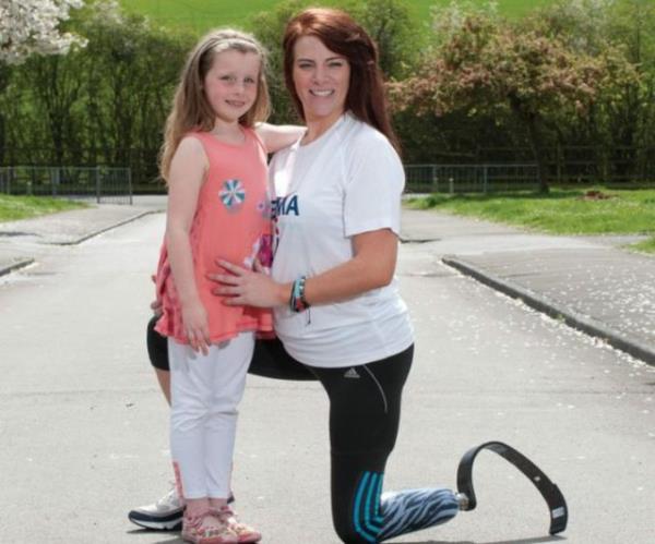 Gen kadnn bir baca, bir gz, sann bir ksm protez.