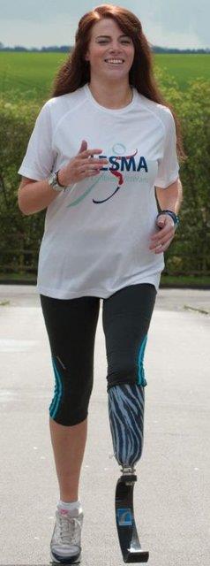 Yzne botox yaptran, bacandaki yalar aldran, karnn gerdiren Campbell, midesine de kelepe taktrp zayflam.