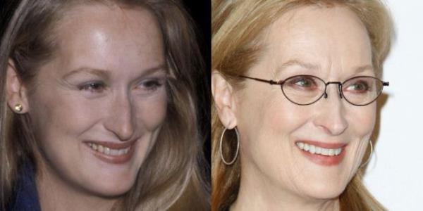 Meryl Streep, 65  <br>1979 2014.</br>