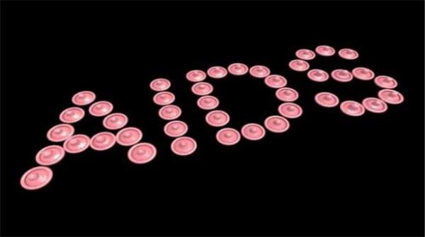 <p><b>HASTALIIN BELRTLER:</b></p>   Fiziksel ve zihinsel aktiviteleri etkileyen, sebebi aklanamayan ar bir yorgunluk, zayflama yada diyet gibi herhangi bir aktivite sz konusu olmadan iki aydan ksa bir srede 7-10 kilo kayb, birka haftann sonunda atein aklanamayacak bir ekilde 39 derecenin stne kmas, uyku srasnda kiinin stn srlsklam edecek derecede terleme, sebebi bilinmeyen bir ekilde vcuttaki salg bezlerinin kabarmas, dilin zerinde ve az iinde beyaz noktalar yada lekelerin olumas, srarla devam eden ishal, herhangi bir solunum enfeksiyonuyla meydana gelen ve ok uzun sren kuru ksrk, zellikle ksrkle birlikte oluan nefes darl, deri stnde ya da altnda oluan kat kat, yada ykselen bir ekilde leke ve iliklerin meydana gelmesi. Balangta rkm gibi alglanabilir fakat bunlar zamanla kaybolmazlar ve genellikle etraflarndaki derilerden ok daha serttirler.