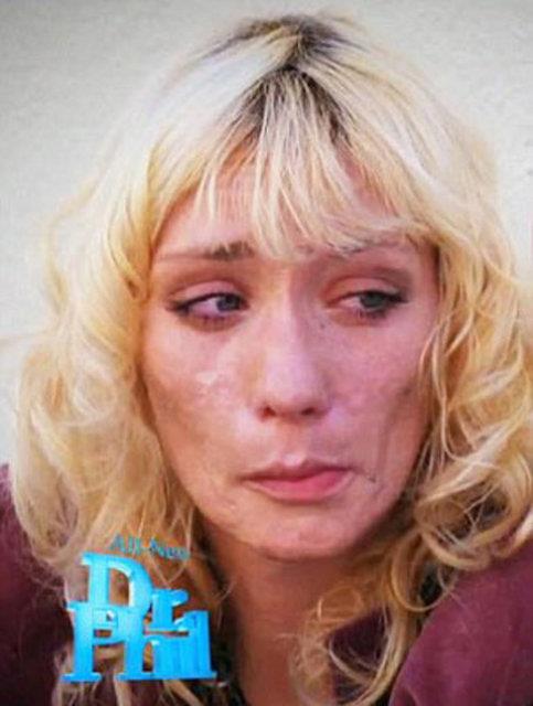 "Dnyann en zararl uyuturucu maddesi" olarak tanmlanan metamfetamin, 28 yandaki gen kadn tannmaz hale getirdi.