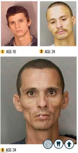 King, gzaltna alnan uyuturucu bamllarn fotoraflarn ekip bunlar arivlemiti.