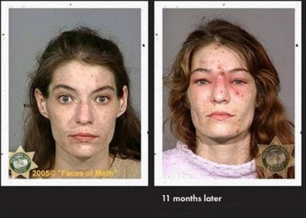 Yeni uyuturucu kart reklam filmi, uyuturucunun bamlsna yapt dehet verici fiziksel ykm gzler nne serdi.