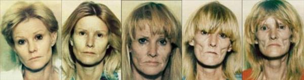 Yeni uyuturucu kart reklam filmi, uyuturucunun bamlsna yapt dehet verici fiziksel ykm gzler nne serdi.