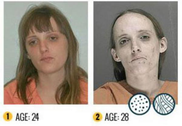 Yeni uyuturucu kart reklam filmi, uyuturucunun bamlsna yapt dehet verici fiziksel ykm gzler nne serdi.