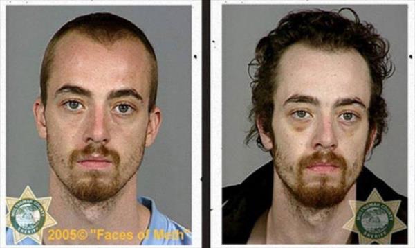 Yeni uyuturucu kart reklam filmi, uyuturucunun bamlsna yapt dehet verici fiziksel ykm gzler nne serdi.