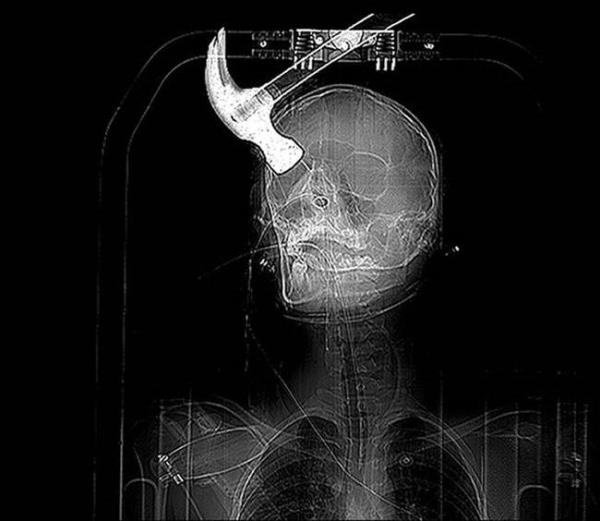 18 yandaki Connor Huntley'nin hayat arkada Joseph Williams' sinirlendirmesiyle tamamen deiti. Joseph sinirlendii Connor'n kafasna bir ekile vurdu ve sonu...