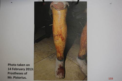 Kz arkada Reeva Steenkamp' ldren Oscar Pistorius, cinayeti iledikten sonra zeri kan iinde grlyor. Pistorius'un ortu neredeyse tamamen renk deitirmi. Oradan ayaklarna kadar kan akyor.