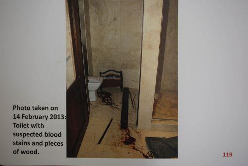 Ampute atletin protez bacann kanlar iindeki hali