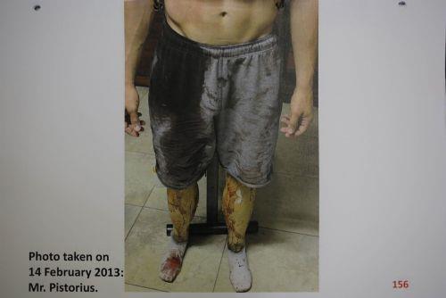 Mahkeme kaytlarndan alnan fotoraflar korkun cinayeti tm plaklyla gzler nne serdi. 14 ubat 2013 tarihli kaytlarda olay mahallinin neredeyse tamamen kana bulanmas dikkat ekiyor.