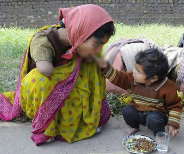 Sakat annesini besleyen 2 yandaki ocuk