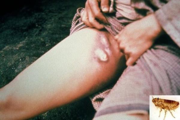 Japonya kinci Dnya Sava srasnda in'i zehirli pirelerle bombalamtr.