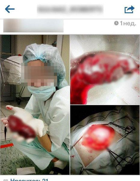 Grevlinin ameliyatta ektii fotoralar instagram hasabna yklemesi byk tartmalara neden oldu.