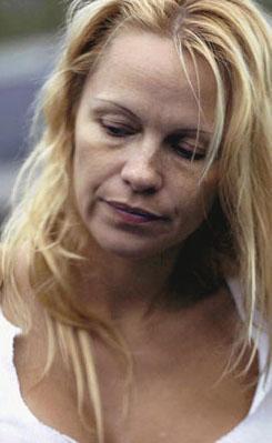 Pamela Anderson da hzl yaam yznden abuk yprand.