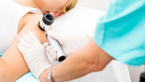 Qureshi'nin nclk ettii bir alma, 20 yana kadar be ya da daha fazla su toplayan yank yaamann melanom riskini yzde 80 arttrdn ortaya kartm.