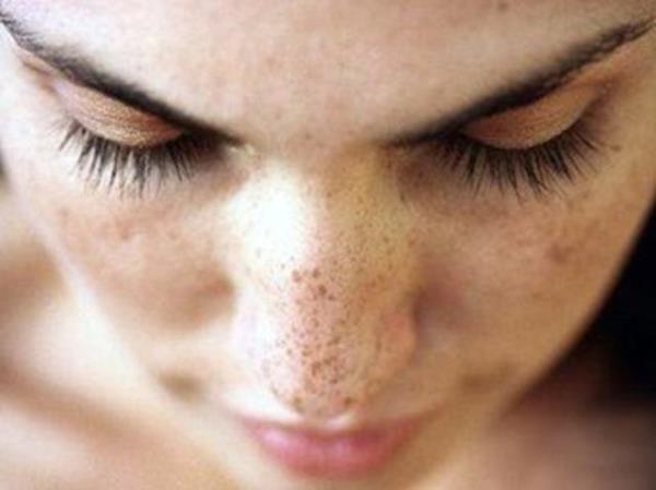 Genlikte oluan cilt hasarlar maalesef tamamen yok edilemiyor. Ama bugnden balayp gnein cildin zerindeki etkilerini azaltmak, bazal ve skuamz hcreli cilt kanserleri gibi melanomu da engellemeye yardm edebilir.